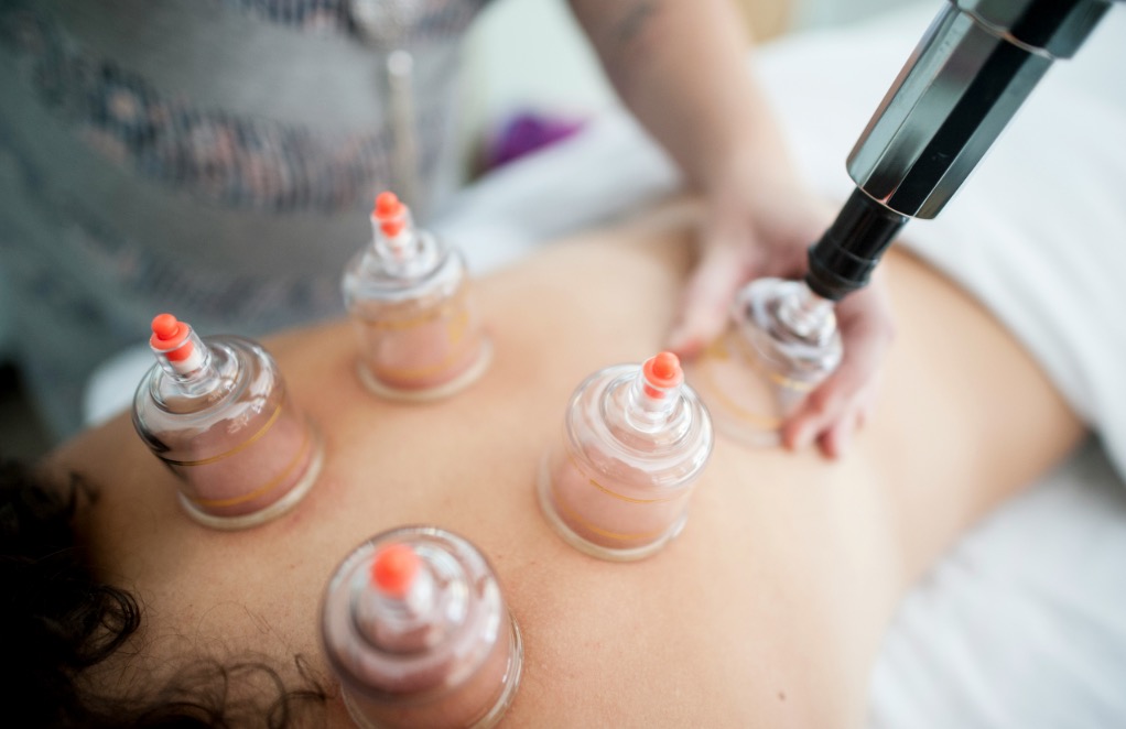 Cupping therapy technique on a client's back